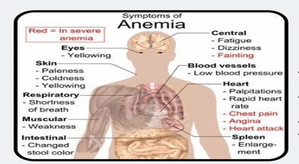 Revamping Anaemia Assessment: What You Should Know