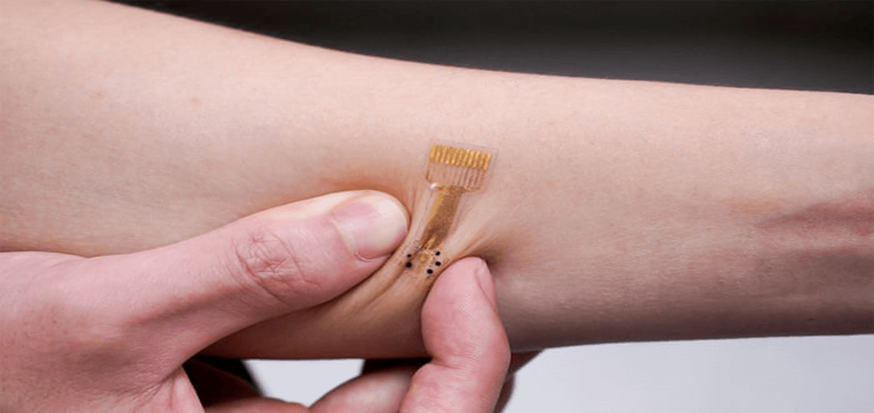 The Promise of Smart Bandages: What You Should Know