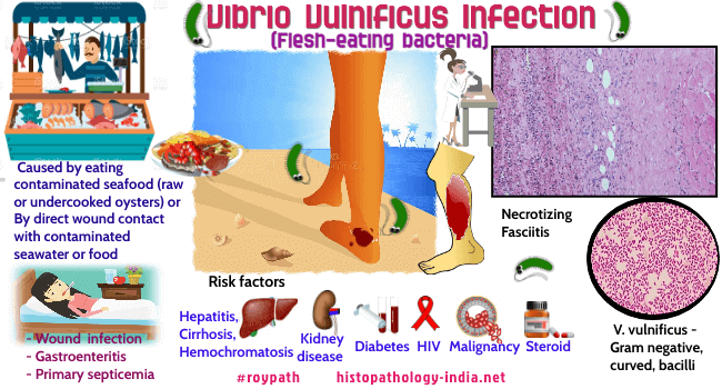 Vibrio vulnificus and Coastal Populations: What You Should Know