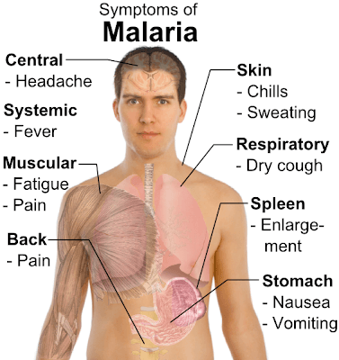 R21/Matrix-M: WHO-Recommended Malaria Vaccine Marks New Era in Global Health