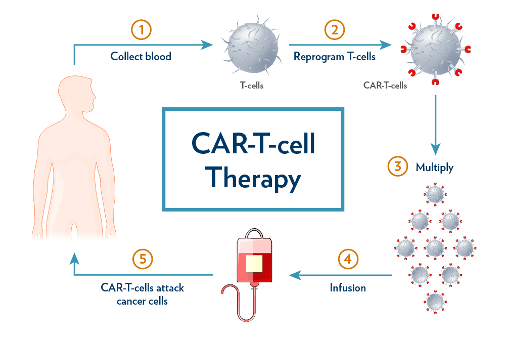 India's Breakthrough: NexCAR19 CAR-T Therapy Pioneers Cancer Treatment Landscape